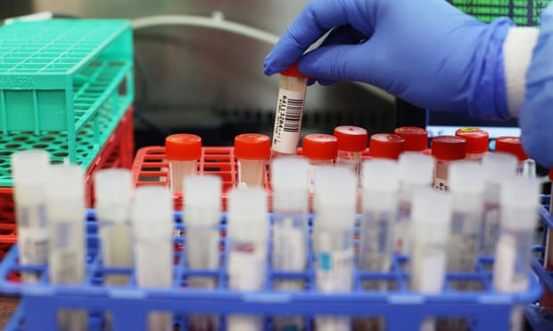 Hai biến chủng SARS-CoV-2 tại Anh nguy hiểm ra sao? - 3