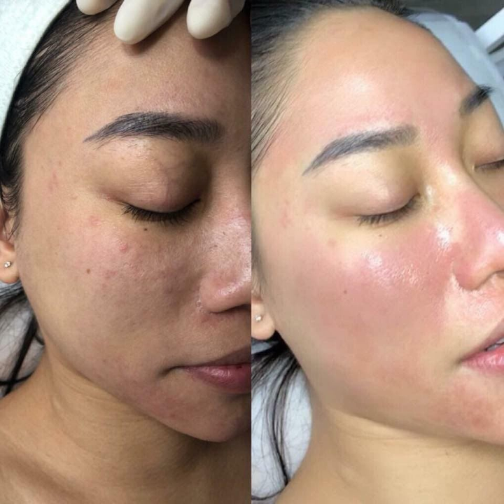 Dịch vụ chăm sóc da cho phái đẹp uy tín tại thẩm mỹ viện Q Clinic & Spa - 3