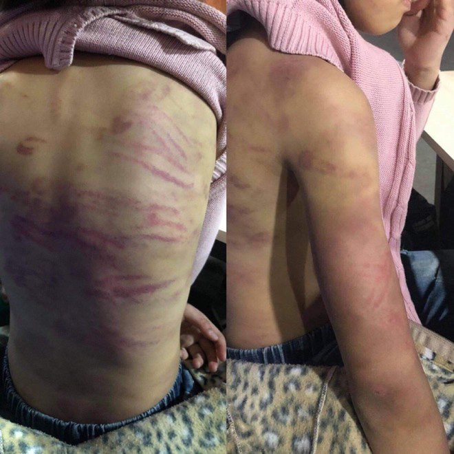 Bé gái nghi bị bạo hành, xâm hại: 'Bố không nhận nuôi, con sẽ vào trại mồ côi' - 1