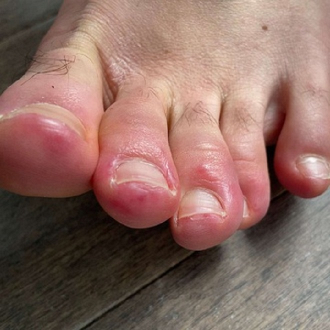 Chuyên gia Anh gợi ý cách có thể phát hiện người nghi mắc COVID-19 - 2