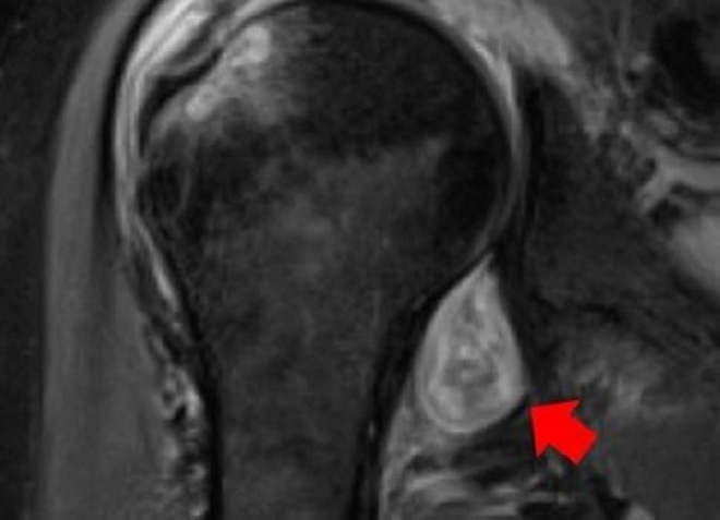 Chuyên gia Anh gợi ý cách có thể phát hiện người nghi mắc COVID-19 - 1