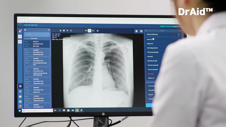 VinBrain lọt vòng chung kết cuộc thi toàn cầu 'Thử thách ứng phó với đại dịch' - 2