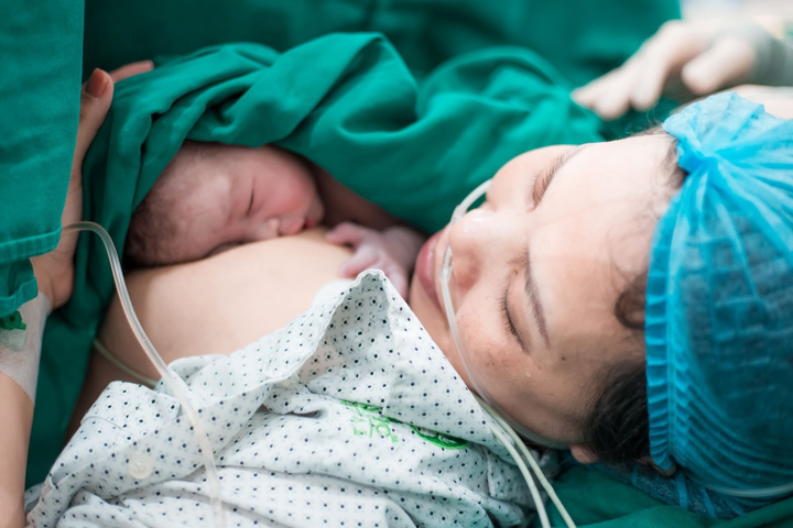 Cuộc 'vượt cạn' thành công của bà bầu mang khối u lớn - 3