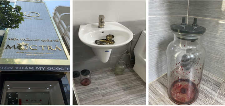 Cơ sở chăm sóc da ở TP.HCM lén phẫu thuật thẩm mỹ gây tai biến - 1