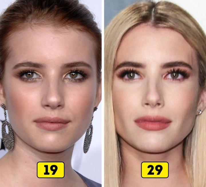 Ảnh: Nhan sắc các sao thế giới thay đổi thế nào trong 10 năm qua?