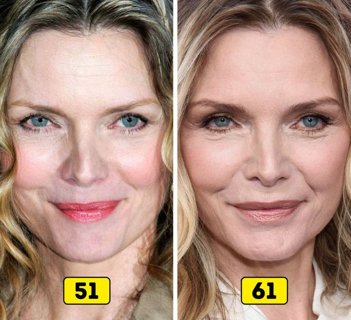 Ảnh: Nhan sắc các sao thế giới thay đổi thế nào trong 10 năm qua?