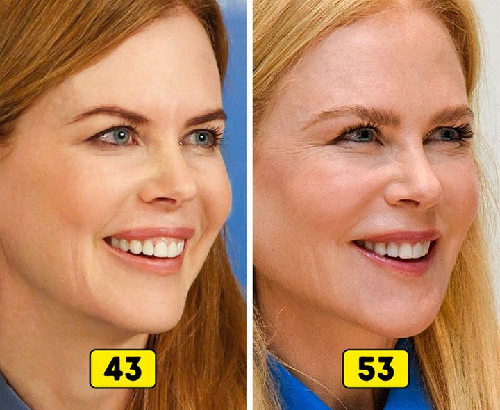 Ảnh: Nhan sắc các sao thế giới thay đổi thế nào trong 10 năm qua?