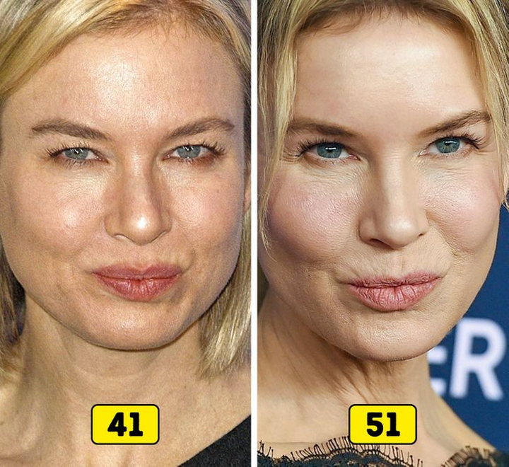 Ảnh: Nhan sắc các sao thế giới thay đổi thế nào trong 10 năm qua?