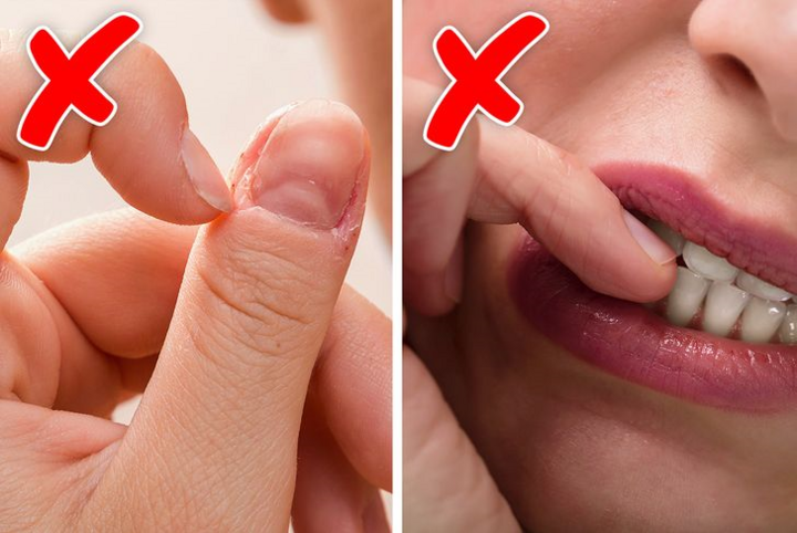 Thói quen cắn móng tay tiết lộ gì về bạn? - 5