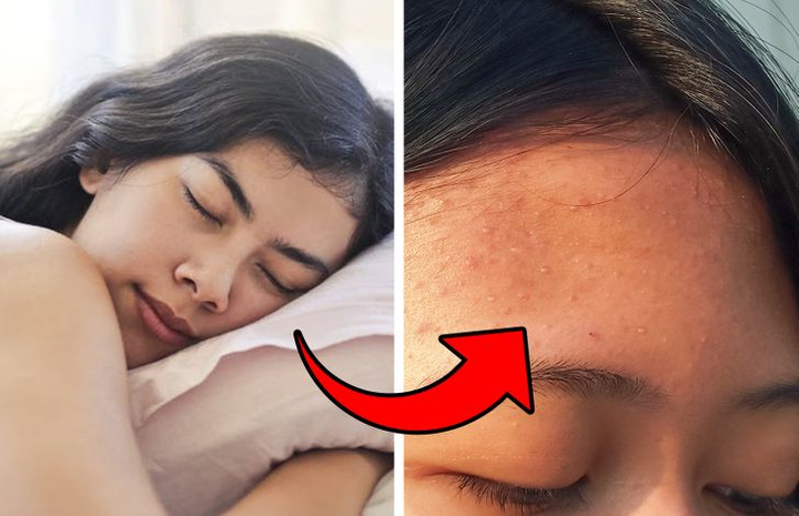 Vì sao không nên mặc một bộ đồ ngủ mấy ngày liên tiếp? - 5