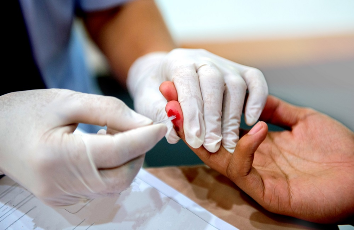 Việt Nam áp dụng bao nhiêu phương pháp xét nghiệm HIV? - 2
