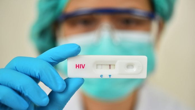 Việt Nam áp dụng bao nhiêu phương pháp xét nghiệm HIV? - 1