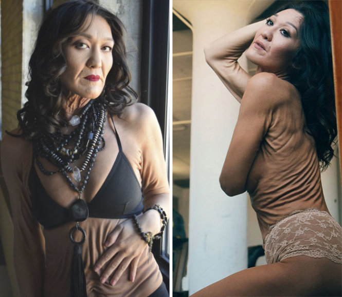 Đừng tự ti, cô gái đặc biệt này sẽ cho bạn thấy sức mạnh đáng gờm của sự tự tin - 5