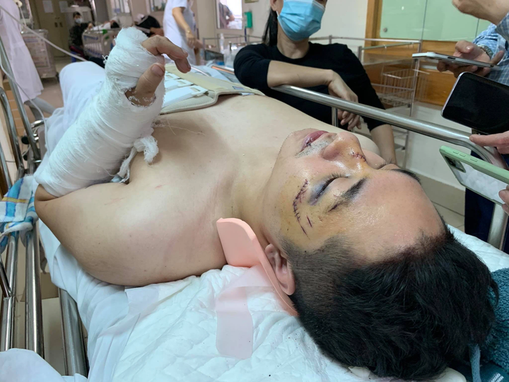 Hai người rơi do sập trần chung cư: Nạn nhân bị gãy xương cột sống - 1