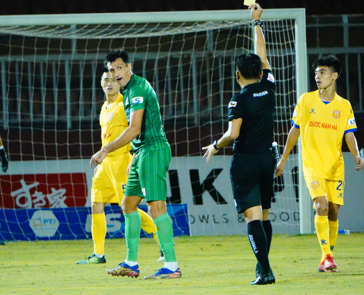 Đầu gối cầu thủ đội Sài Gòn biến dạng sau cú đạp từ đối thủ - 7