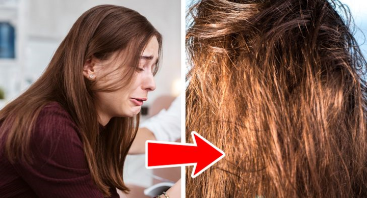 Tóc bết dầu phải làm sao để khắc phục? - 5