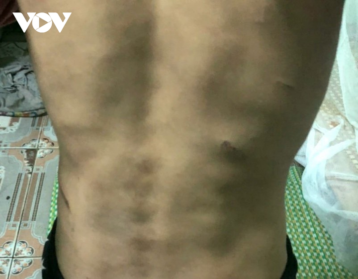 Khởi tố người mẹ hành hạ dã man con gái ruột ở Hải Dương - 2