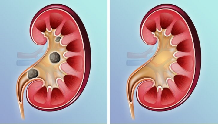 Điều gì xảy ra khi bạn ăn quá nhiều thịt? - 7