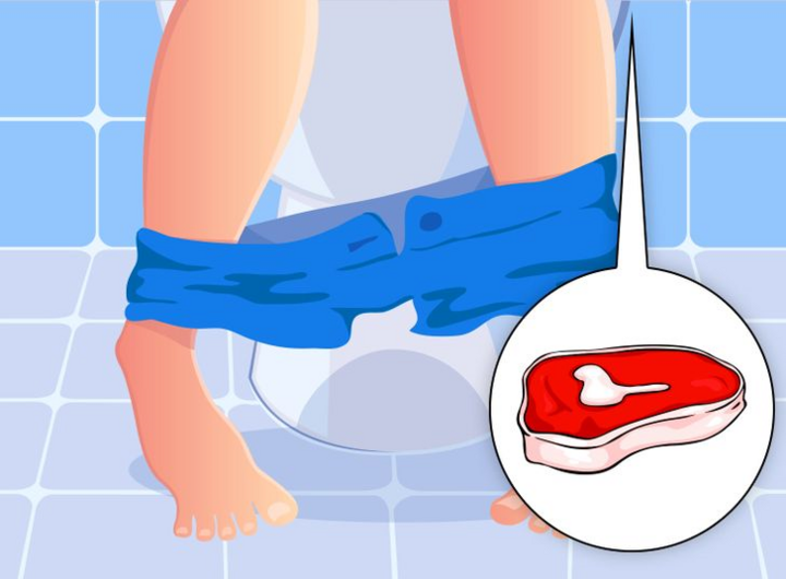 Điều gì xảy ra khi bạn ăn quá nhiều thịt? - 8