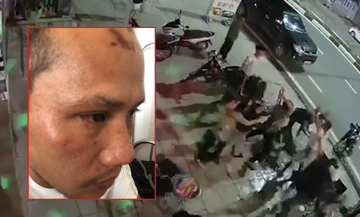 Triệu tập nhóm côn đồ đánh dã man người đàn ông ở quán nhậu - 1