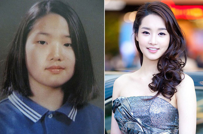 Sự thật bất ngờ về bức ảnh khiến Park Min Young bị đồn thổi 'đập mặt xây lại' - 5