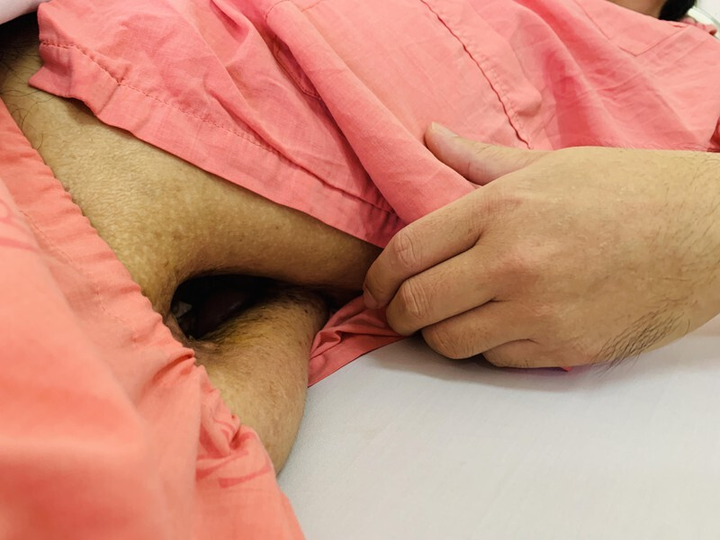 Hành trình 11 năm ròng cứu bệnh nhân vừa được bảo hiểm chi trả hơn 38 tỷ đồng - 2