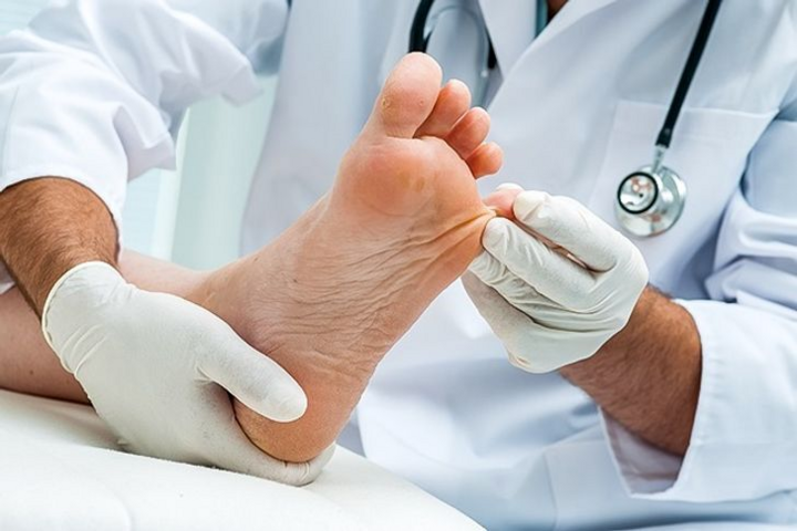 11 mẹo giúp loại bỏ mùi hôi chân rất nhanh - 11