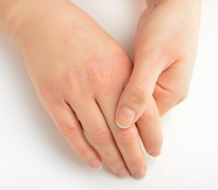 Dấu hiệu cảnh báo sức khỏe bạn có vấn đề - 2