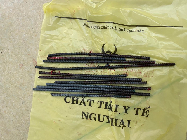 Va chạm với xe ba gác, nam thanh niên bị 11 thanh sắt đâm xuyên chân - 2