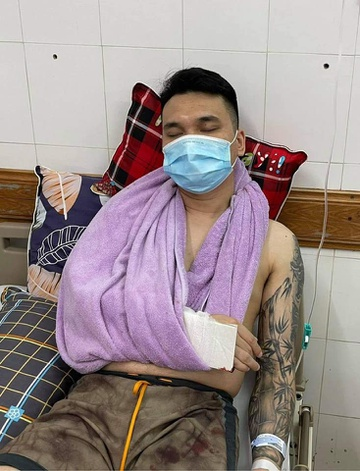 Khắc Việt bị gãy tay, phải hủy loạt show - 1