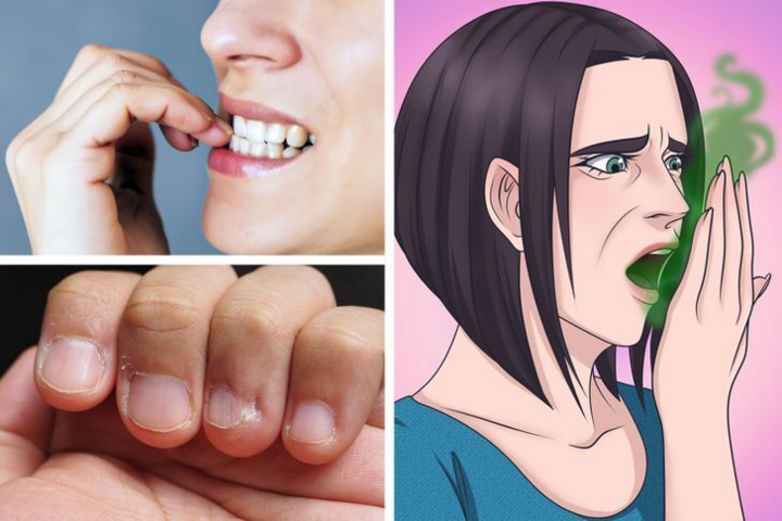 Thói quen cắn móng tay gây hại gì cho sức khoẻ? - 2