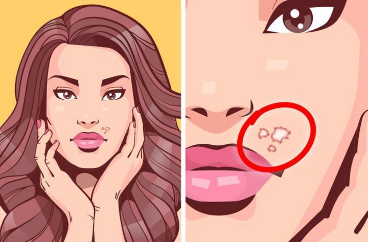 Thói quen cắn móng tay gây hại gì cho sức khoẻ? - 5