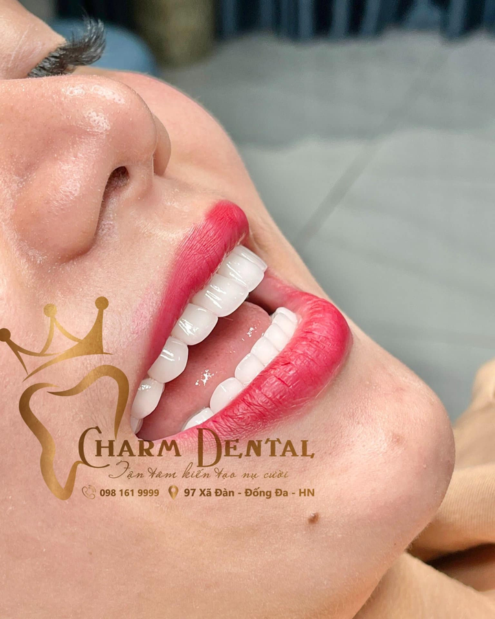 CEO Đỗ Thúy Hằng chia sẻ cách bảo vệ răng từ nguyên liệu tự nhiên - 4