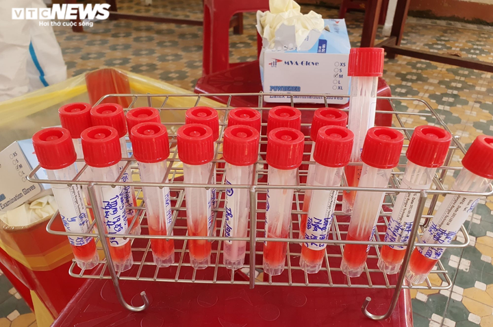 Ảnh: Đà Nẵng xét nghiệm COVID-19 tất cả nhân viên massage, vũ trường, karaoke - 7