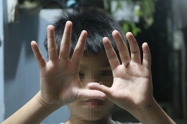 Sự thật thông tin bé trai bị cha đánh dập tay ở TP.HCM - 3