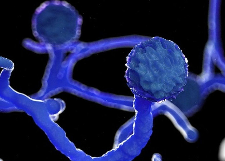 Xuất hiện loại nấm đen chết người trong não bệnh nhân COVID-19 Ấn Độ - 4