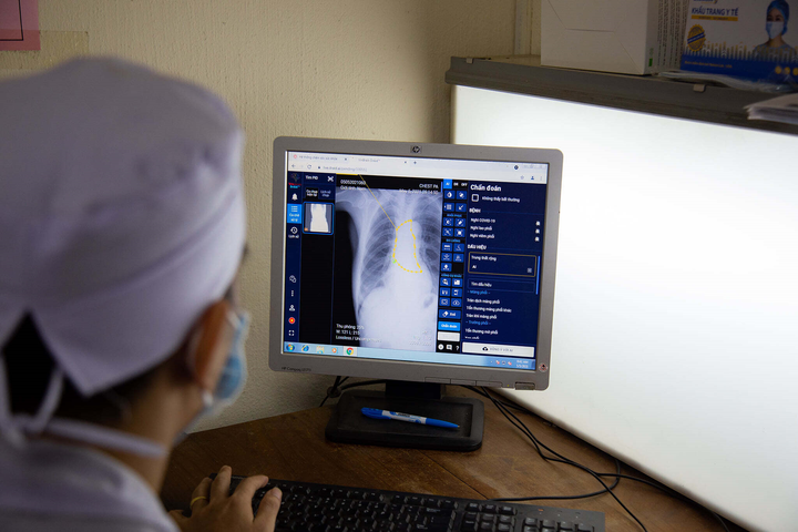 Bảo vệ thành trì chống dịch COVID -19 bằng đẩy mạnh ứng dụng AI trong y tế - 2