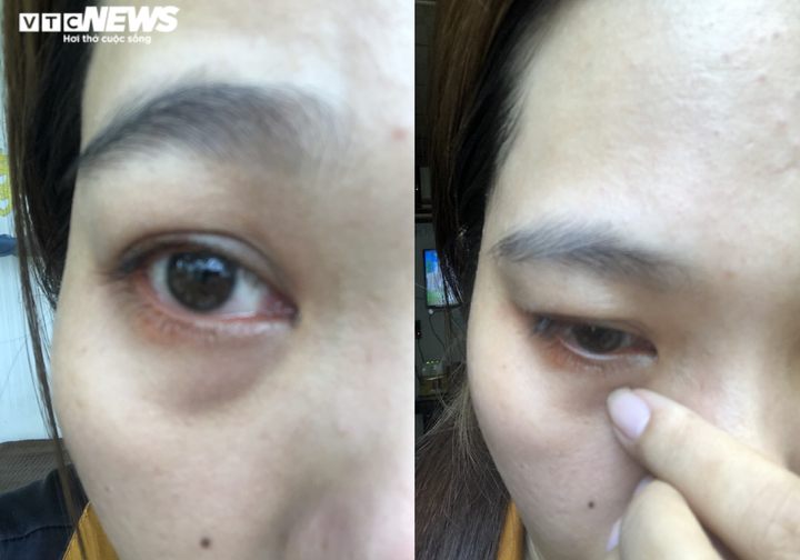 Công an truy bắt nhóm xịt hơi cay vô cớ vào hàng loạt phụ nữ ở Tiền Giang - 2