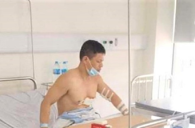 Tài xế kể giây phút sinh tử, chiến đấu với tên cướp hung ác trong xe taxi - 1