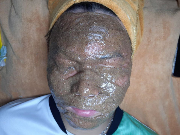 Giật mình trước các kiểu đắp mặt nạ 'làm đẹp là chính, hù dọa là 10' - 3