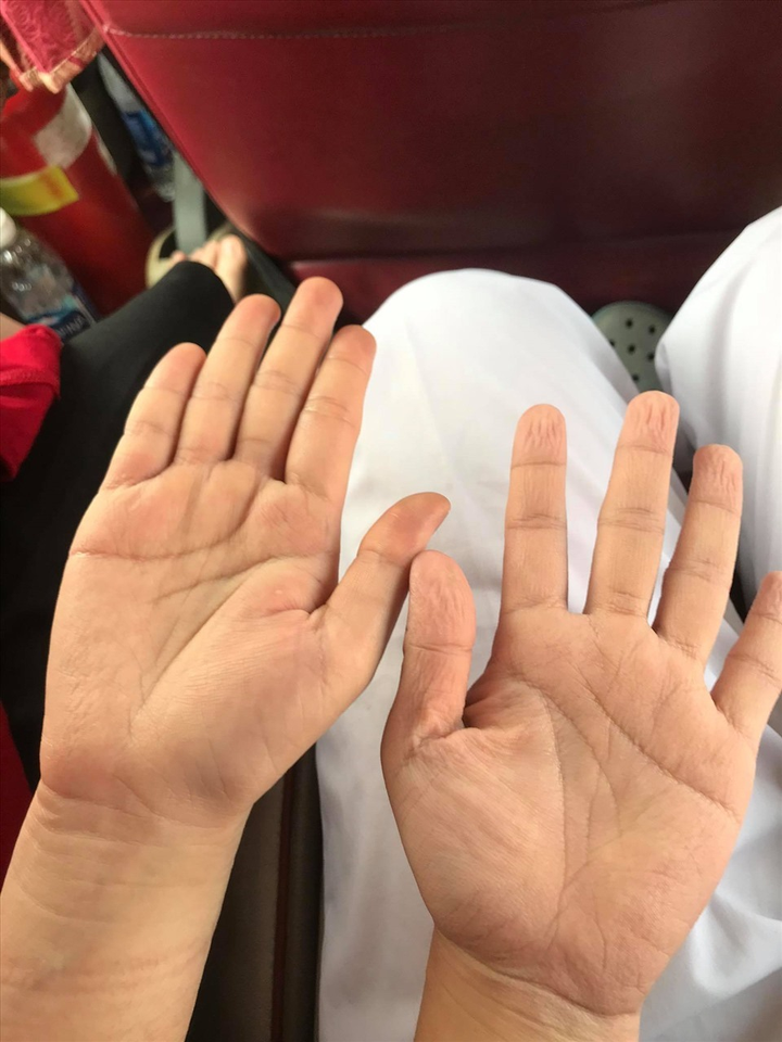 Sinh viên ở tâm dịch: Mồ hôi ướt sũng, lưng phồng rộp, trắng đêm lấy mẫu - 1