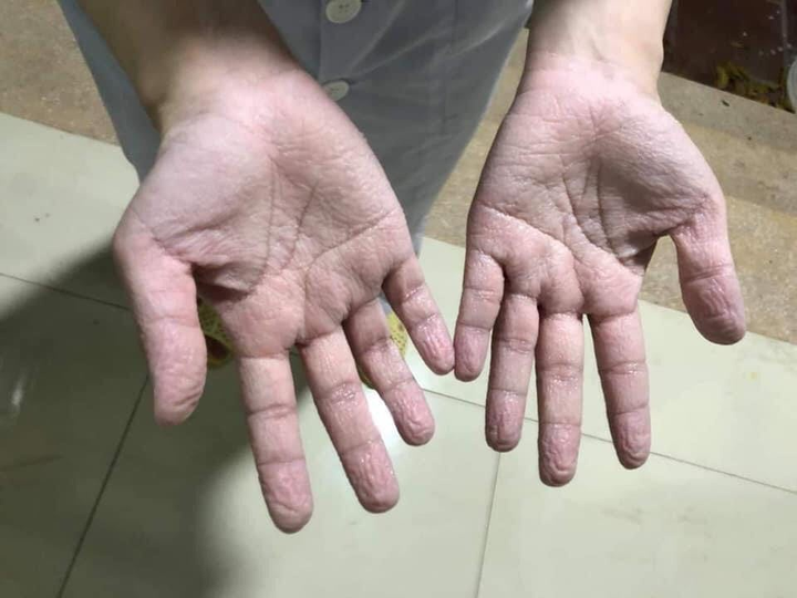 Ảnh: Đội quân áo trắng lấy mẫu xét nghiệm COVID-19 ở ổ dịch lớn nhất cả nước - 6