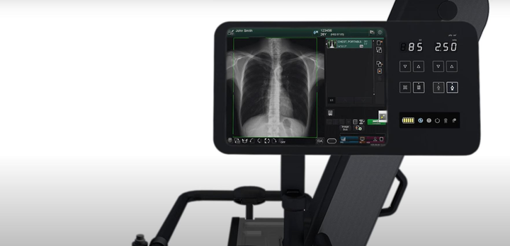 Máy X-Quang Nhật Bản tích hợp trí tuệ nhân tạo đến TP.HCM chống dịch - 3