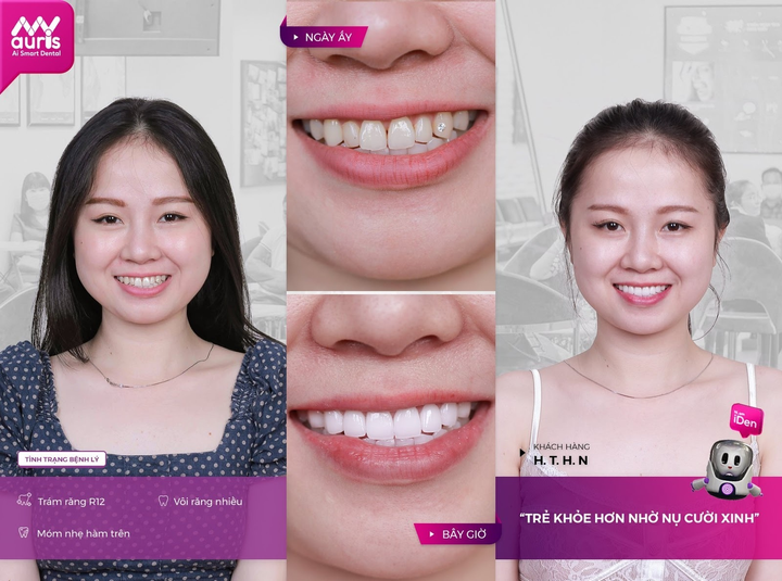 Nha Khoa Thông Minh Auris: Địa chỉ tin cậy của mọi khách hàng - 4