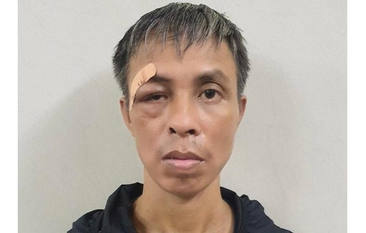 Khởi tố kẻ vô cớ dùng kính đâm vào cổ bệnh nhân điều trị cùng phòng - 1