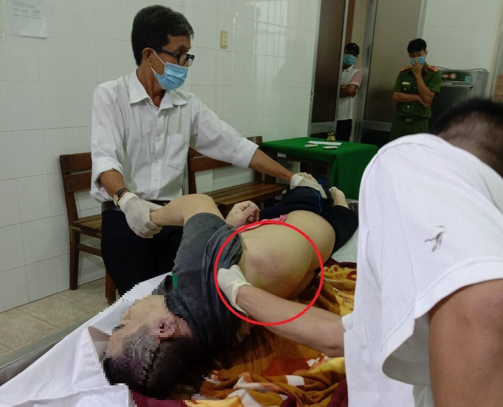 Bị can chết khi đang tạm giam ở Tiền Giang, thi thể có nhiều vết bầm tím - 1