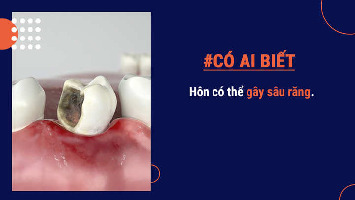 Có ai biết: Chào hỏi bằng cách hôn vệ sinh hơn việc bắt tay - 5