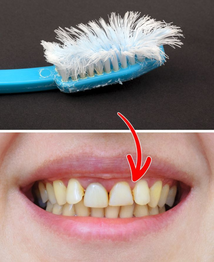 6 thói quen khiến răng bạn ố vàng - 4