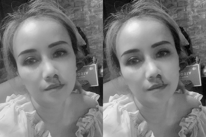 Điều tra vụ diễn viên Hoàng Yến 'Về nhà đi con' tố cáo bị chồng cũ đánh - 1