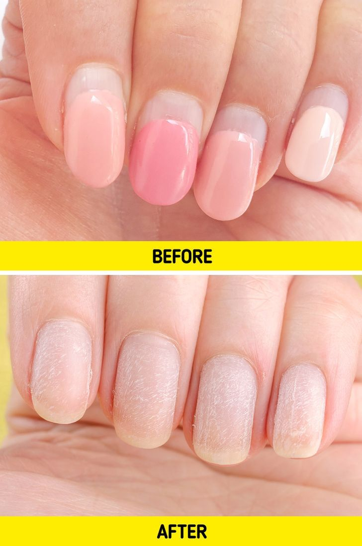 7 thói quen hàng ngày làm hỏng móng tay bạn - 4